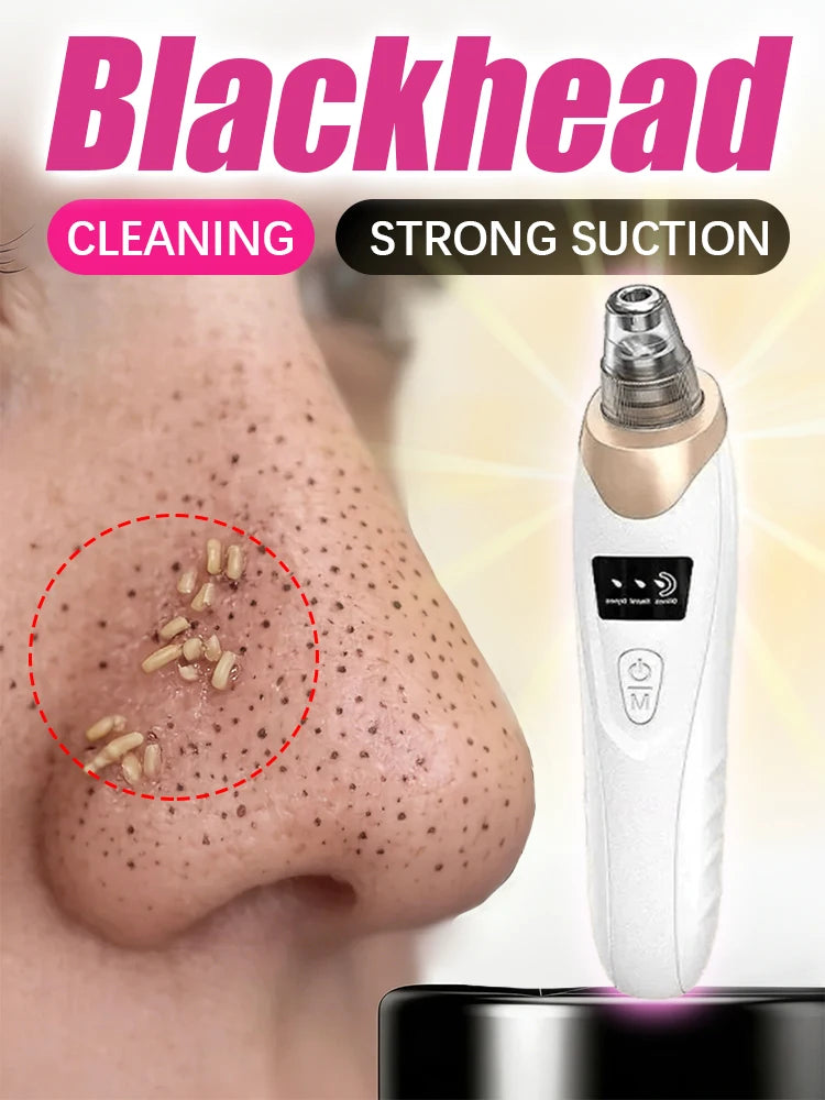 WellNest Pore Vacuum Blackhead Remover